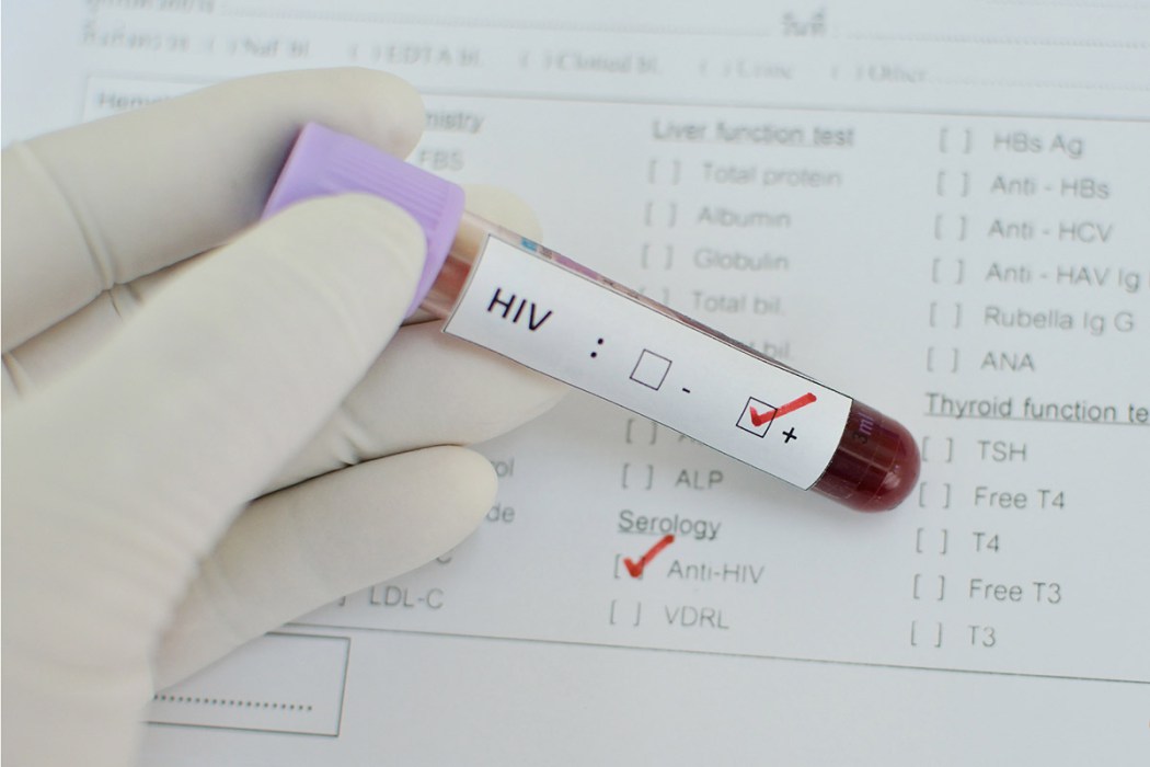 The Millennials and HIV